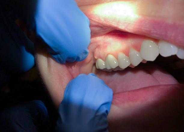 Best Emergency Dental Services for Seniors in Grove, OK